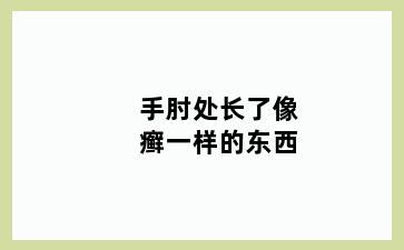 手肘处长了像癣一样的东西